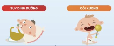 Phân biệt trẻ còi xương và trẻ suy dinh dưỡng